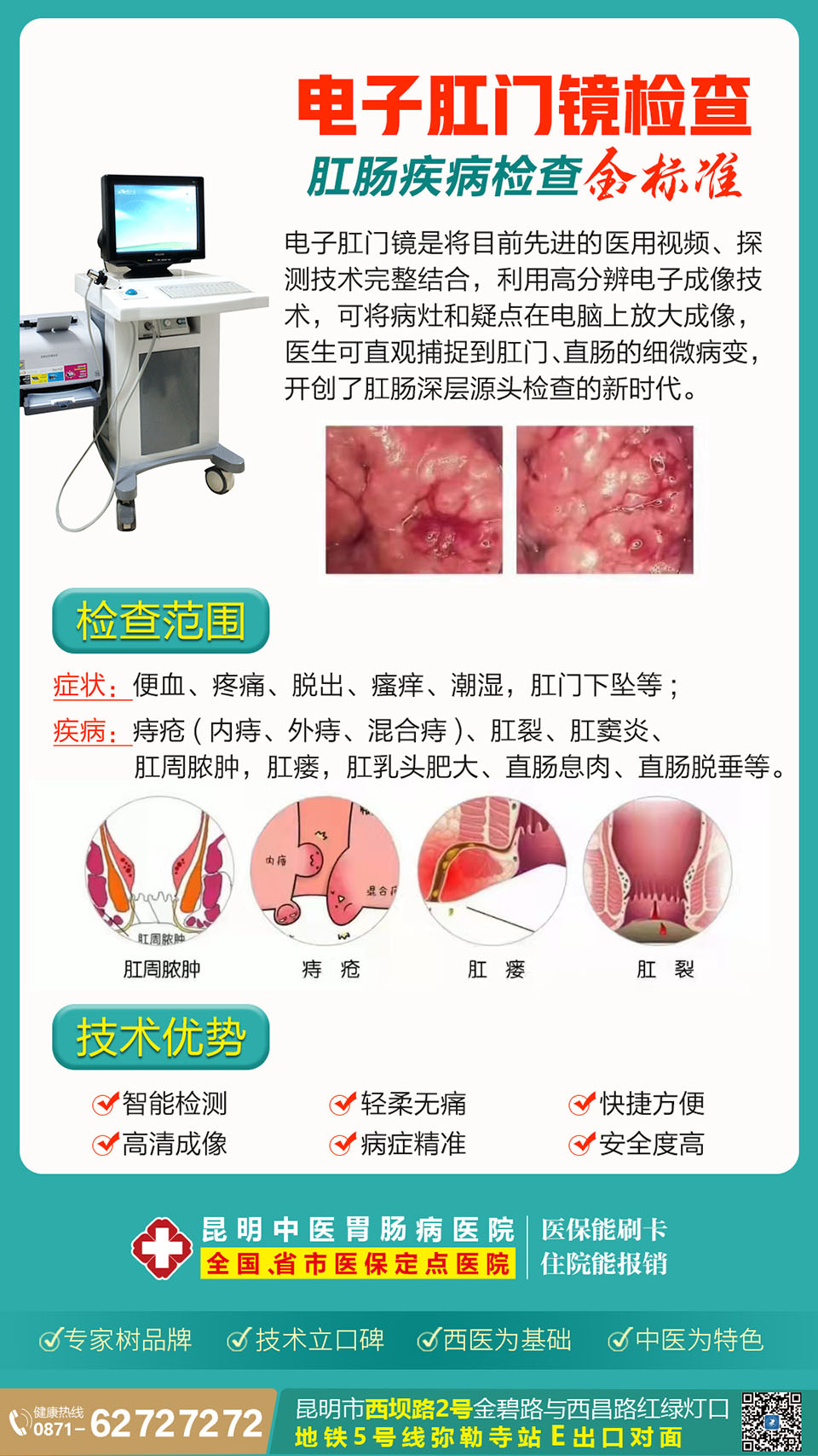 昆明中醫(yī)胃腸病醫(yī)院電子肛門鏡