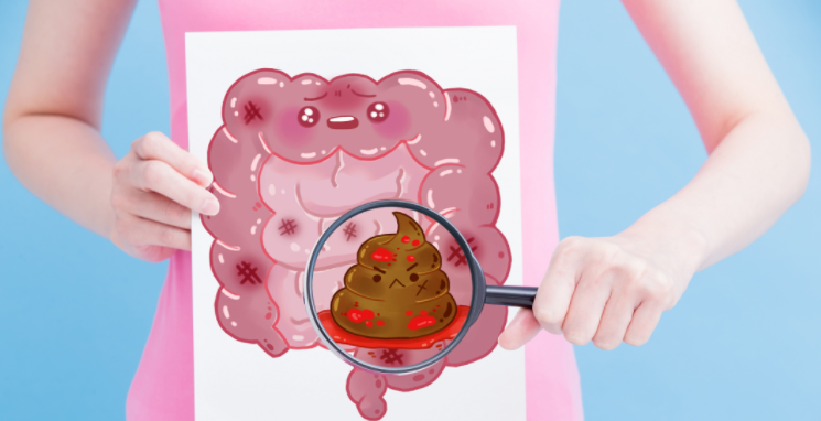 便秘不算“病”嗎？七種情況的便秘，可能是腫瘤先兆！